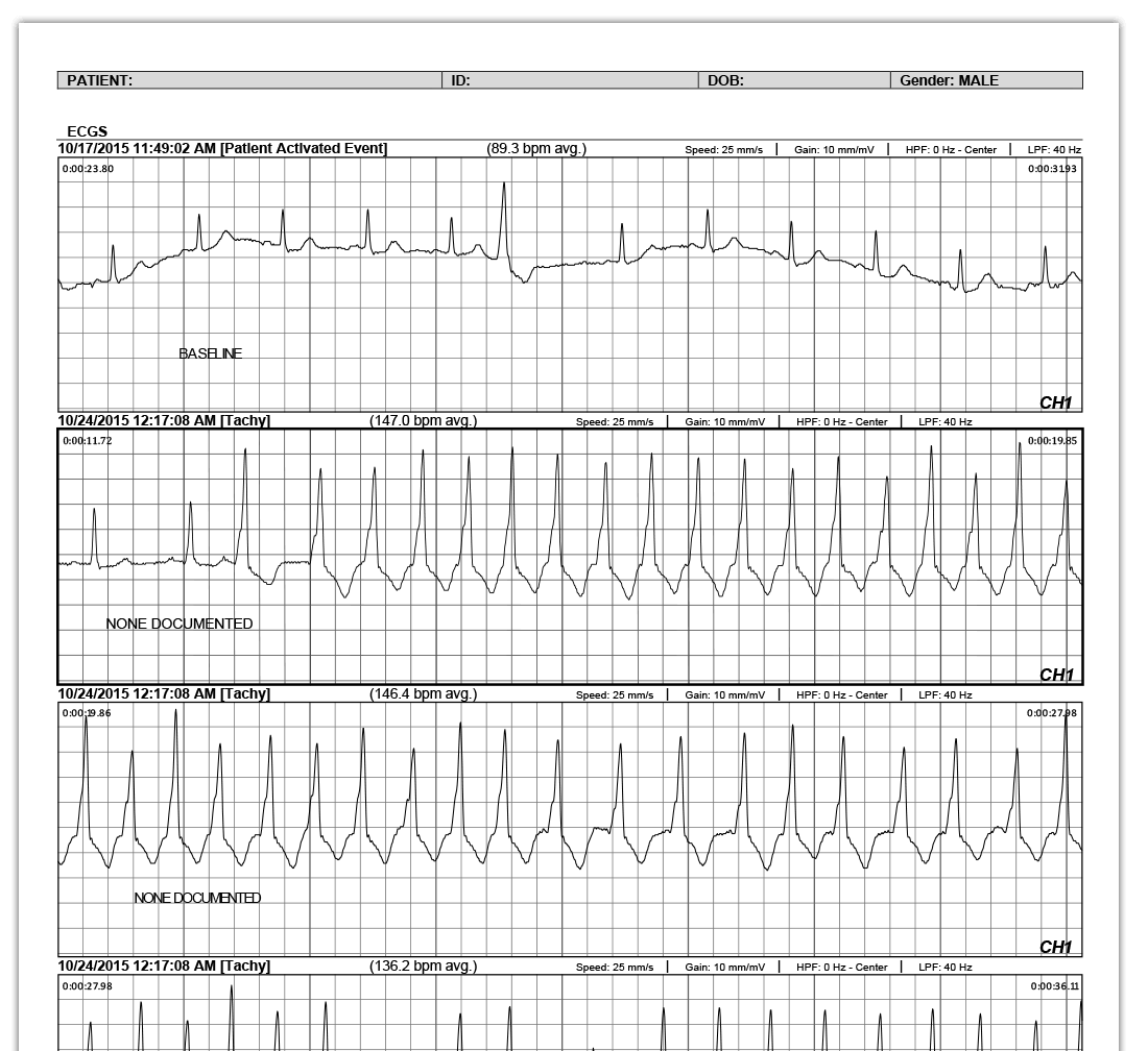 Cardiophone Loop Monitor Sample Report